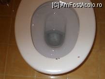 [P03] Capacul de la wc, asa cum l-am gasit » foto by mihaiu77
 - 
<span class="allrVoted glyphicon glyphicon-heart hidden" id="av13201"></span>
<a class="m-l-10 hidden" id="sv13201" onclick="voting_Foto_DelVot(,13201,3028)" role="button">șterge vot <span class="glyphicon glyphicon-remove"></span></a>
<a id="v913201" class=" c-red"  onclick="voting_Foto_SetVot(13201)" role="button"><span class="glyphicon glyphicon-heart-empty"></span> <b>LIKE</b> = Votează poza</a> <img class="hidden"  id="f13201W9" src="/imagini/loader.gif" border="0" /><span class="AjErrMes hidden" id="e13201ErM"></span>